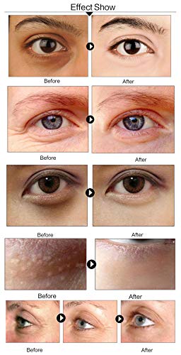 Serum Collagen Maska Za Oči Protiv Starenja Protiv Bora Uklonite Tamne Krugove Torbe Za Oči Gel Kolagen Flaster