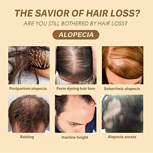 Prirodni sastojci pomažu zdravoj popravci rasta kose gubitak kose čini da kosa raste duže pogodna