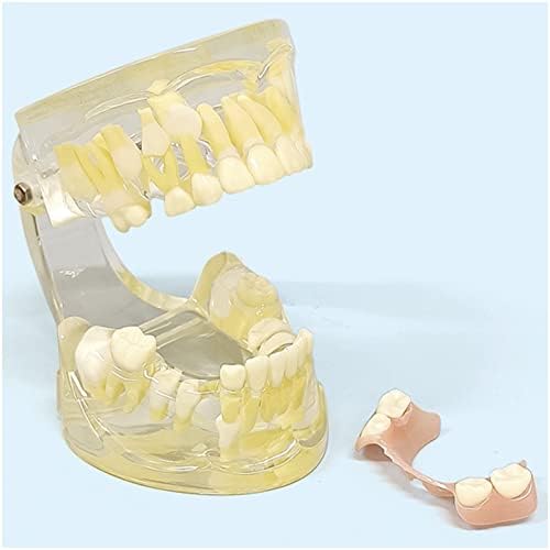 KH66ZKY ruheng naizmenični model zuba, zubni demonstracijski model zuba, za obrazovanje, komunikaciju