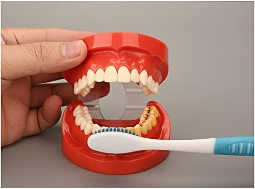 KH66ZKY zubni karijes Model zuba-model zuba karijes-Standardni model nastave zuba alat za proučavanje
