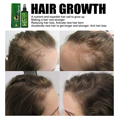 Indijski drevni sprej za ponovni rast kose, Organic Growth Plus hranjivi sprej od đumbira za rast kose za muškarce