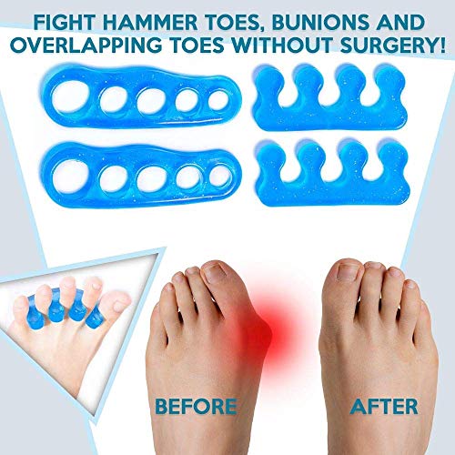 Anatomski Toe separatori i Blue Gel Toe separatori Bundle | Hammer Toe & amp; bunion korektor