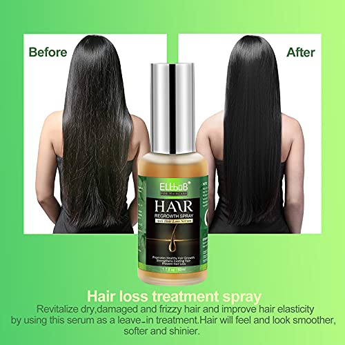 Serum za rast kose-ulje za rast kose za deblju & amp; zdravija kosa, smanjuje opadanje kose biotinom i naprednom