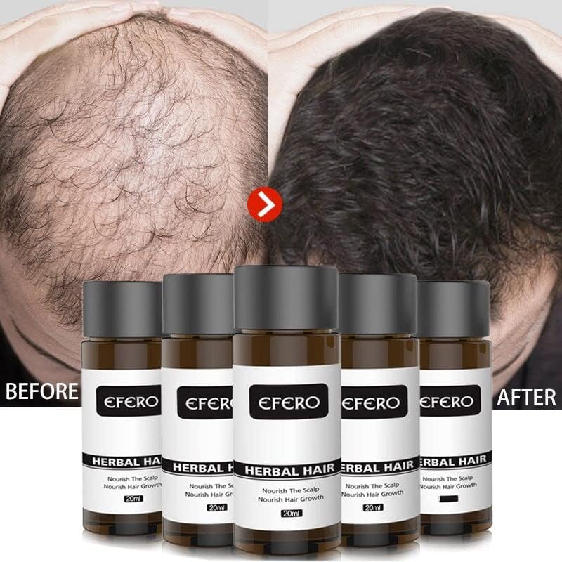 Đumbir Serum esencijalnog ulja za rast kose proizvodi protiv gubitka kose fast Grow Hair Treatment
